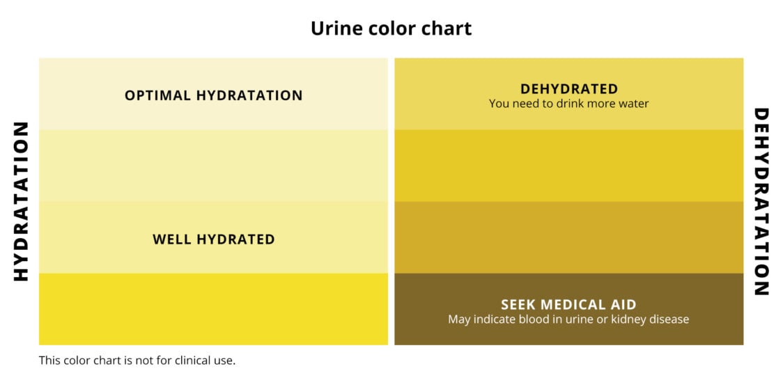 Цветова схема на урината