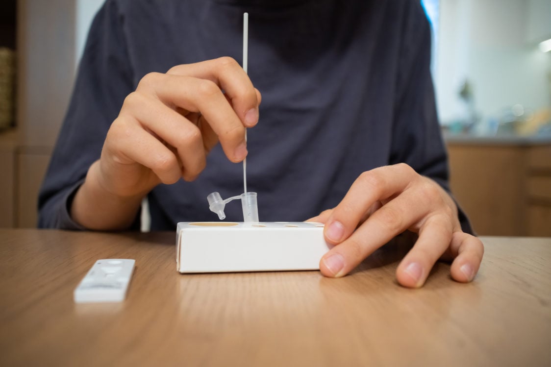 Kde a ako si nechať otestovať svoju reakciu na kofeín?